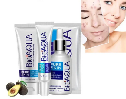 KIT 4x1 Anti Acne Bioaqua™ - ¡OFERTA HASTA AGOTAR EL STOCK!