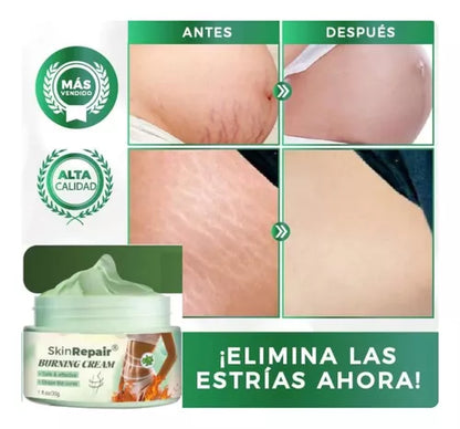 Compra 1 llévate 2 - ANTI ESTRÍAS Y CELULITIS SKIN REPAIR + ENVIO GRATIS